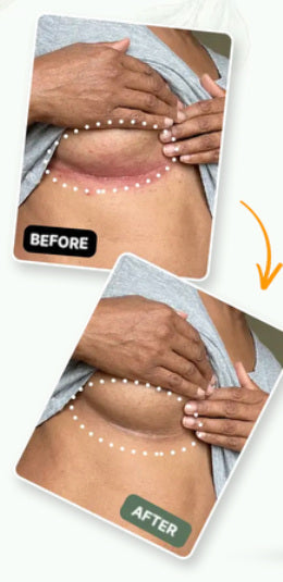 Illustrative reference showing two different skin-fold appearances; not verified Lomovia customer results